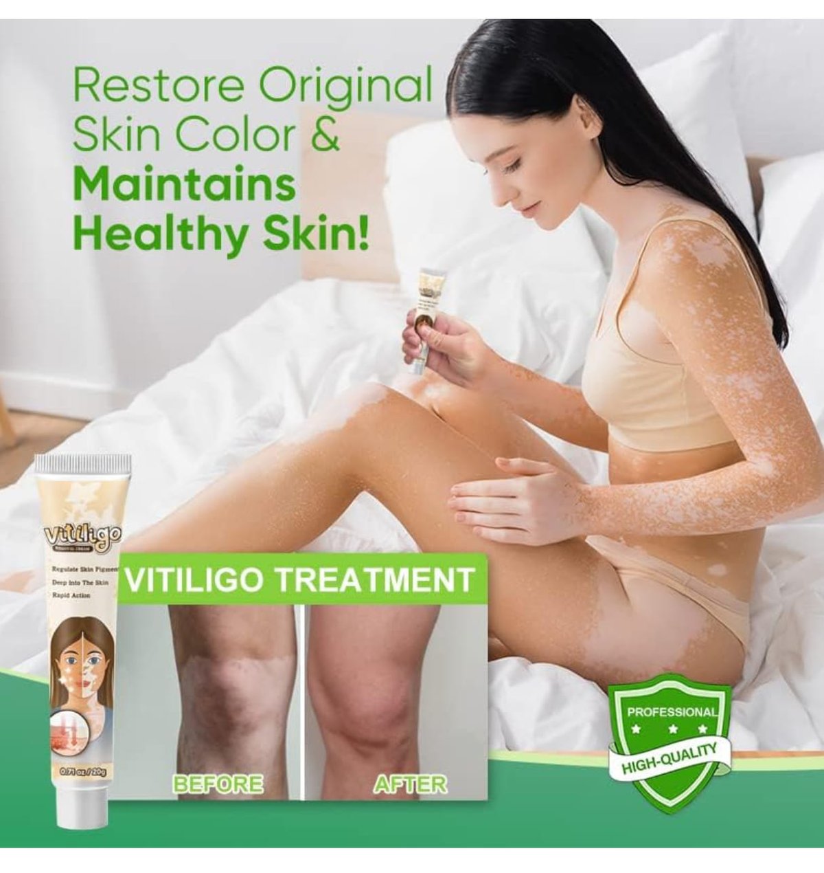 Crema Para Vitiligo - 3