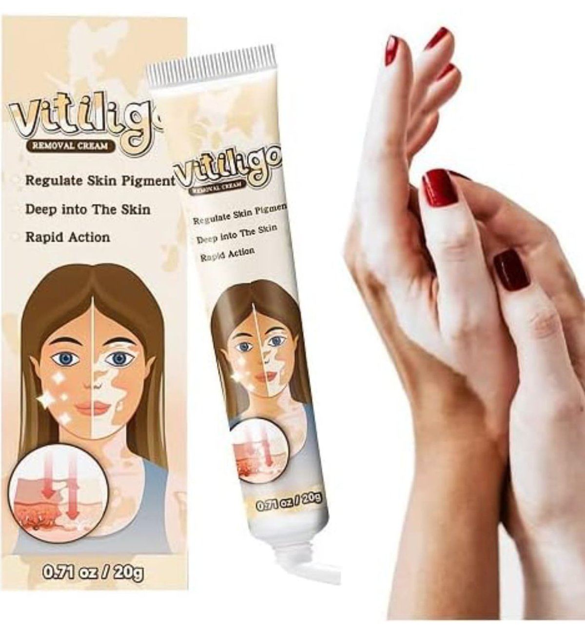 Crema Para Vitiligo