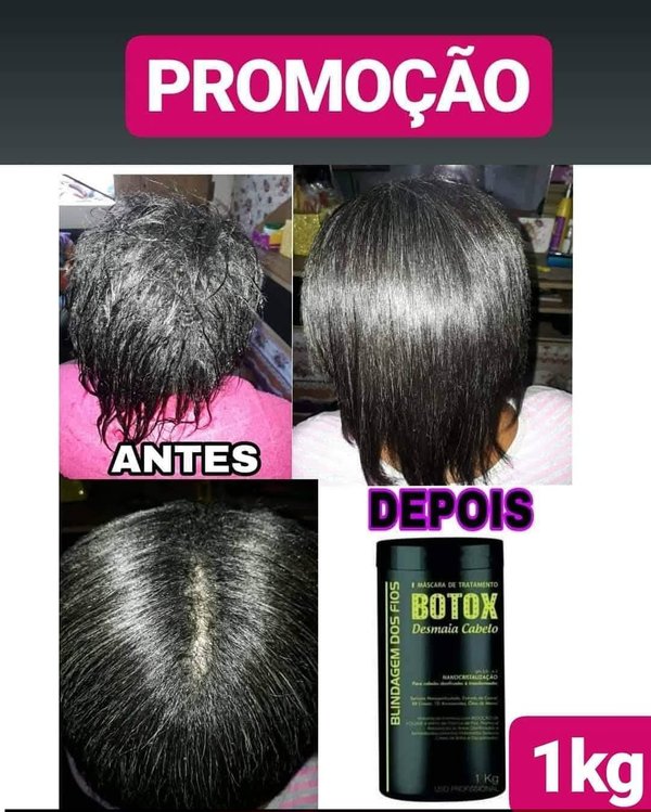 Botox Nano Cristalización✨