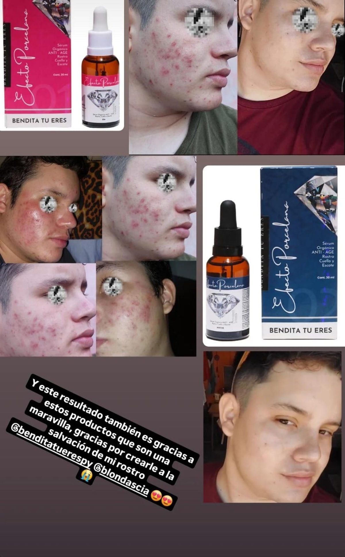 ✨ Pack Sérum Día + Noche – Rutina Completa 24H - 6