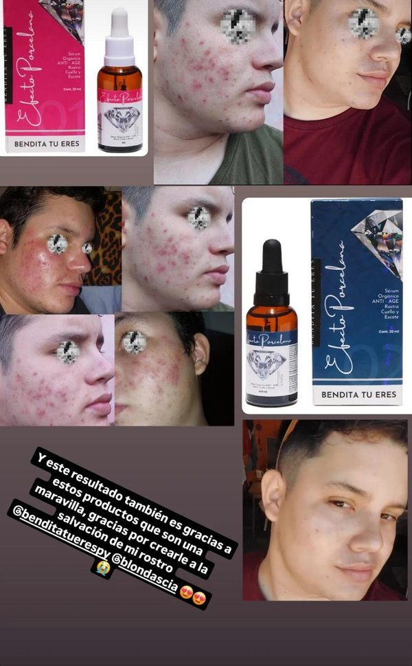 ✨ Pack Sérum Día + Noche – Rutina Completa 24H