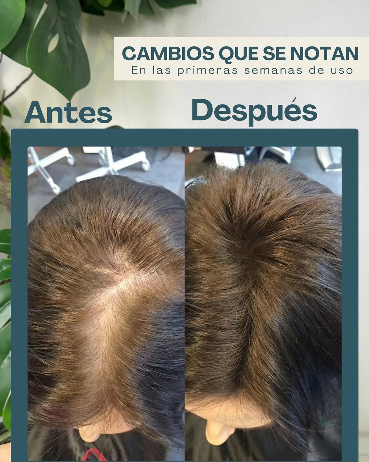 Kit Santo Ricino Paraguay – Crecimiento Capilar, Uñas y Pestañas - 5