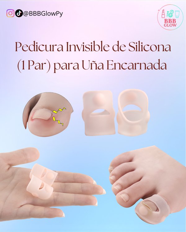 Plantilla Para Uña Encarnada 
