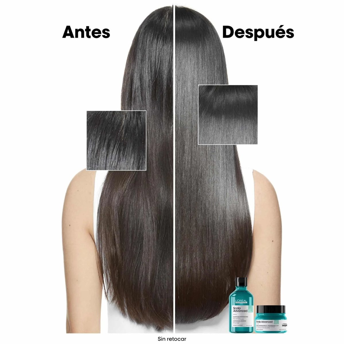 L’Oréal Scalp Advanced Champú antigrasa.