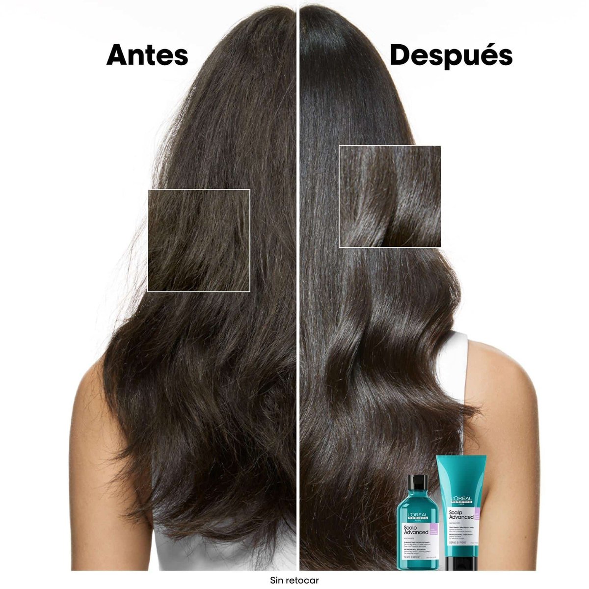 L’Oréal Scalp Advanced Champú anti-malestar