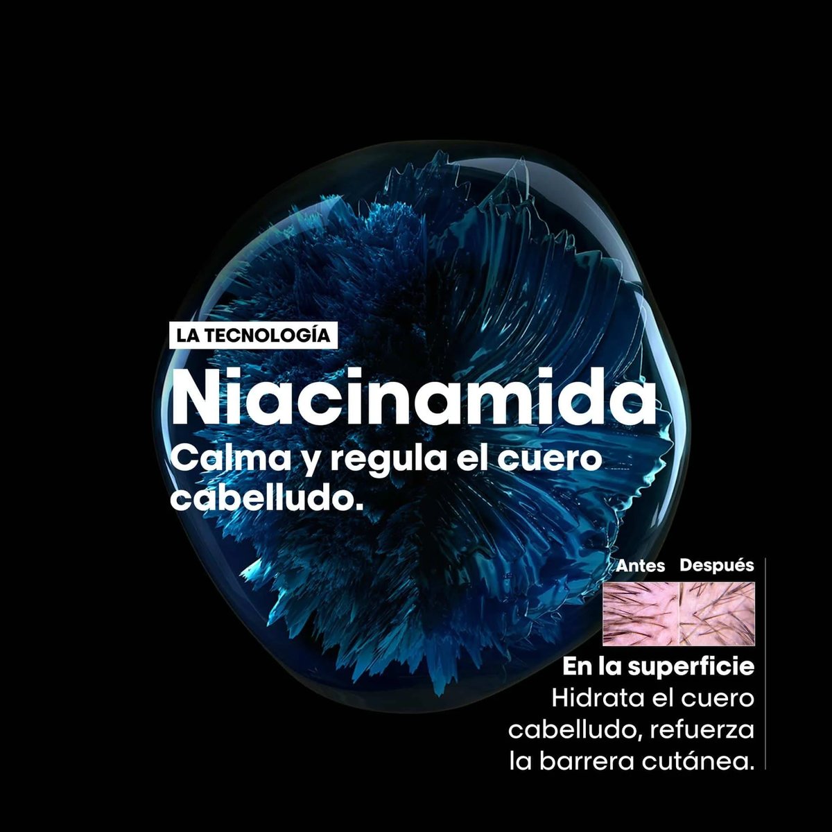 L’Oréal Scalp Advanced Champú anti-malestar