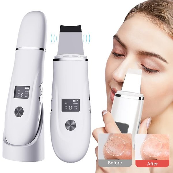 Limpiador Facial Ultrasonico