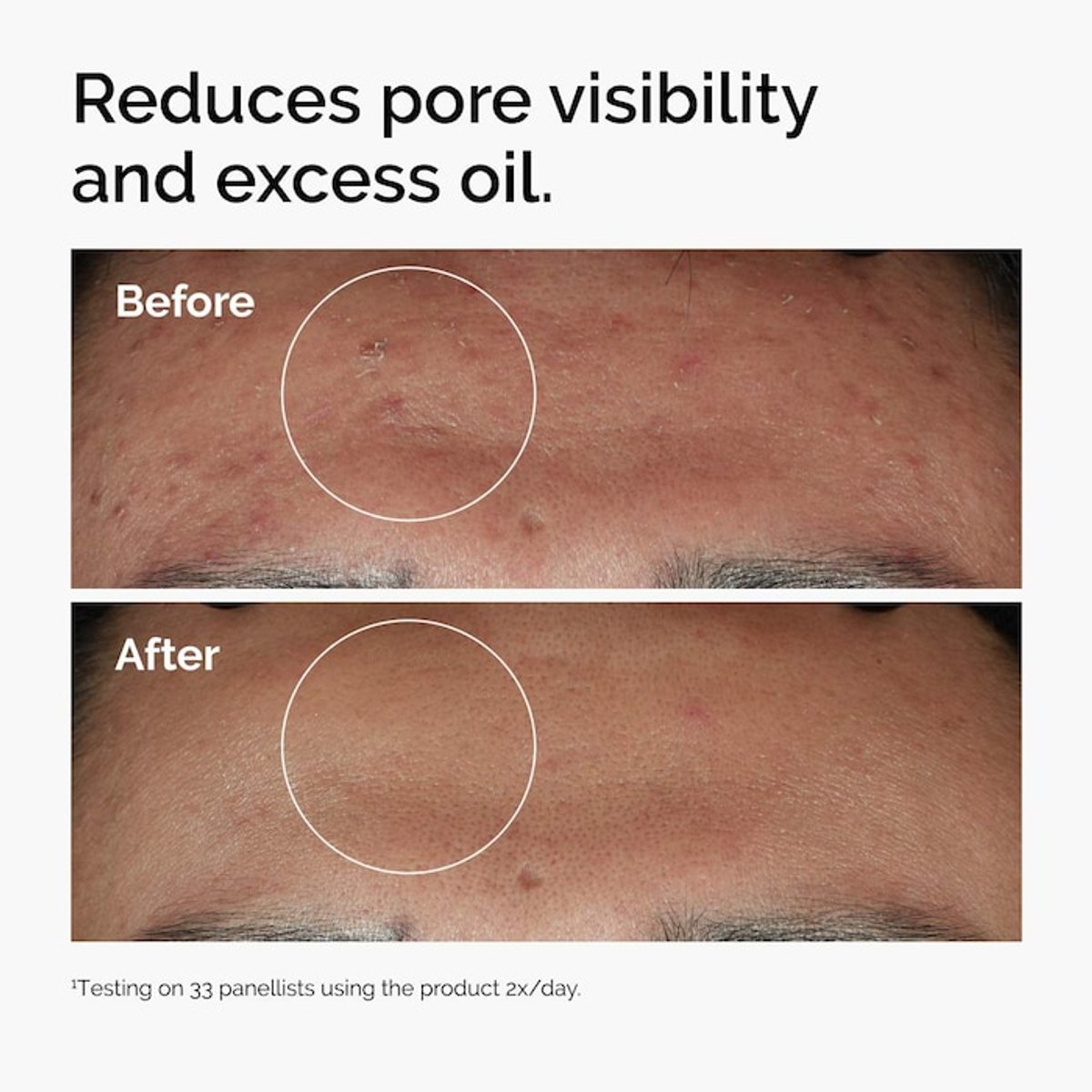 The Ordinary Niacinamide 10% + Zinc 1%  Serum - 2