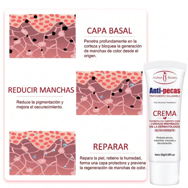 Crema Anti-Pecas Aichun Beauty