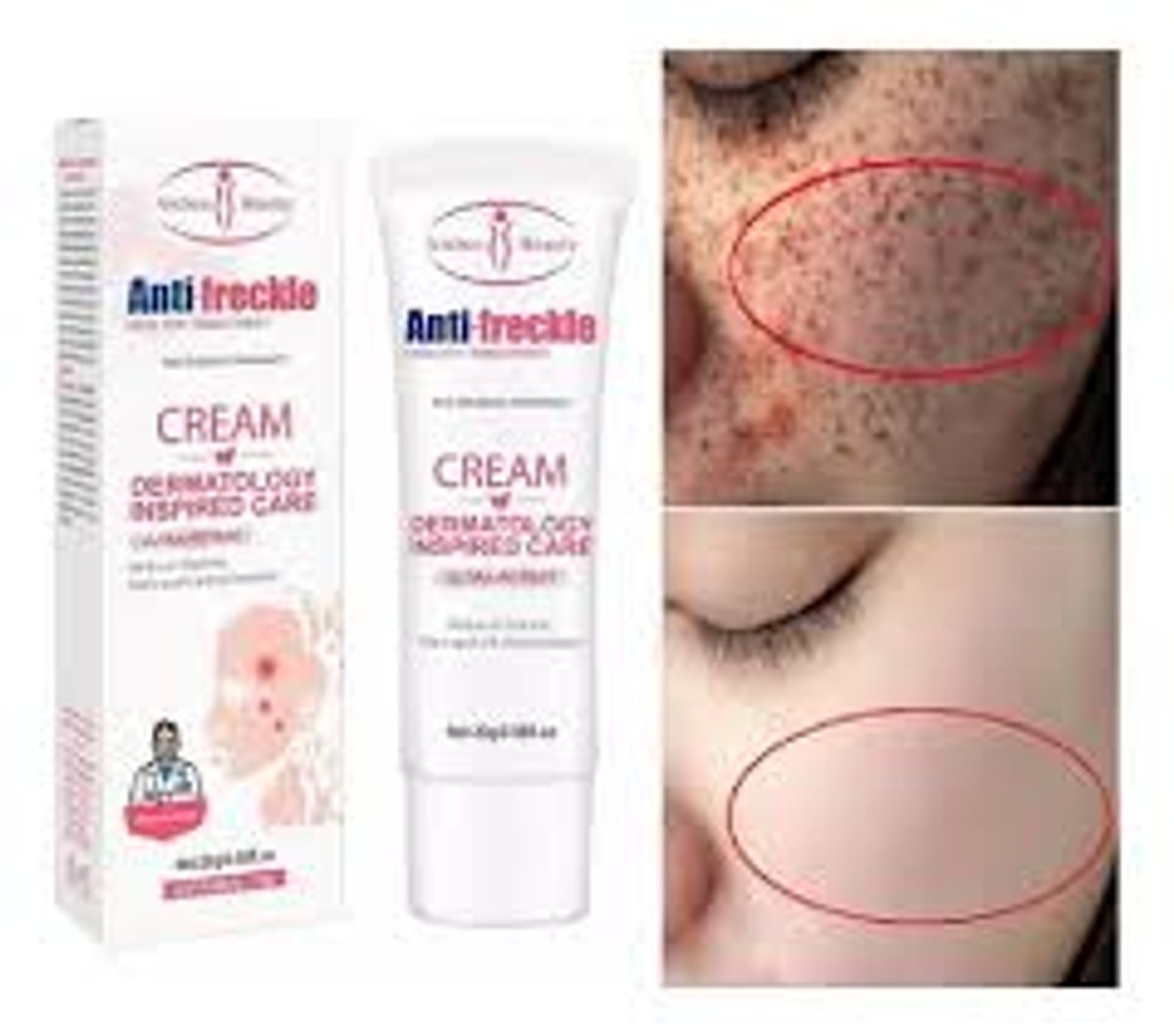 14433 Crema Antimanchas Antipecas - 2