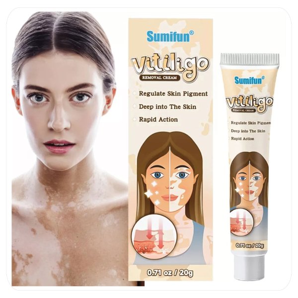 Crema Sumifun Vitiligo 20G..