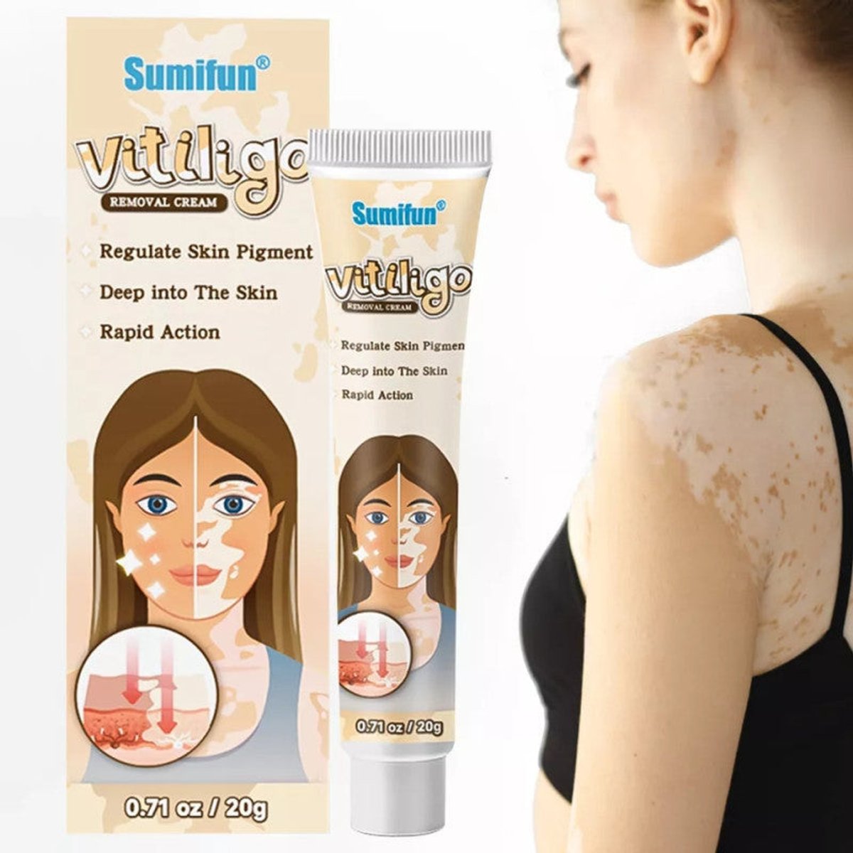 Crema Sumifun Vitiligo 20G.. - 3