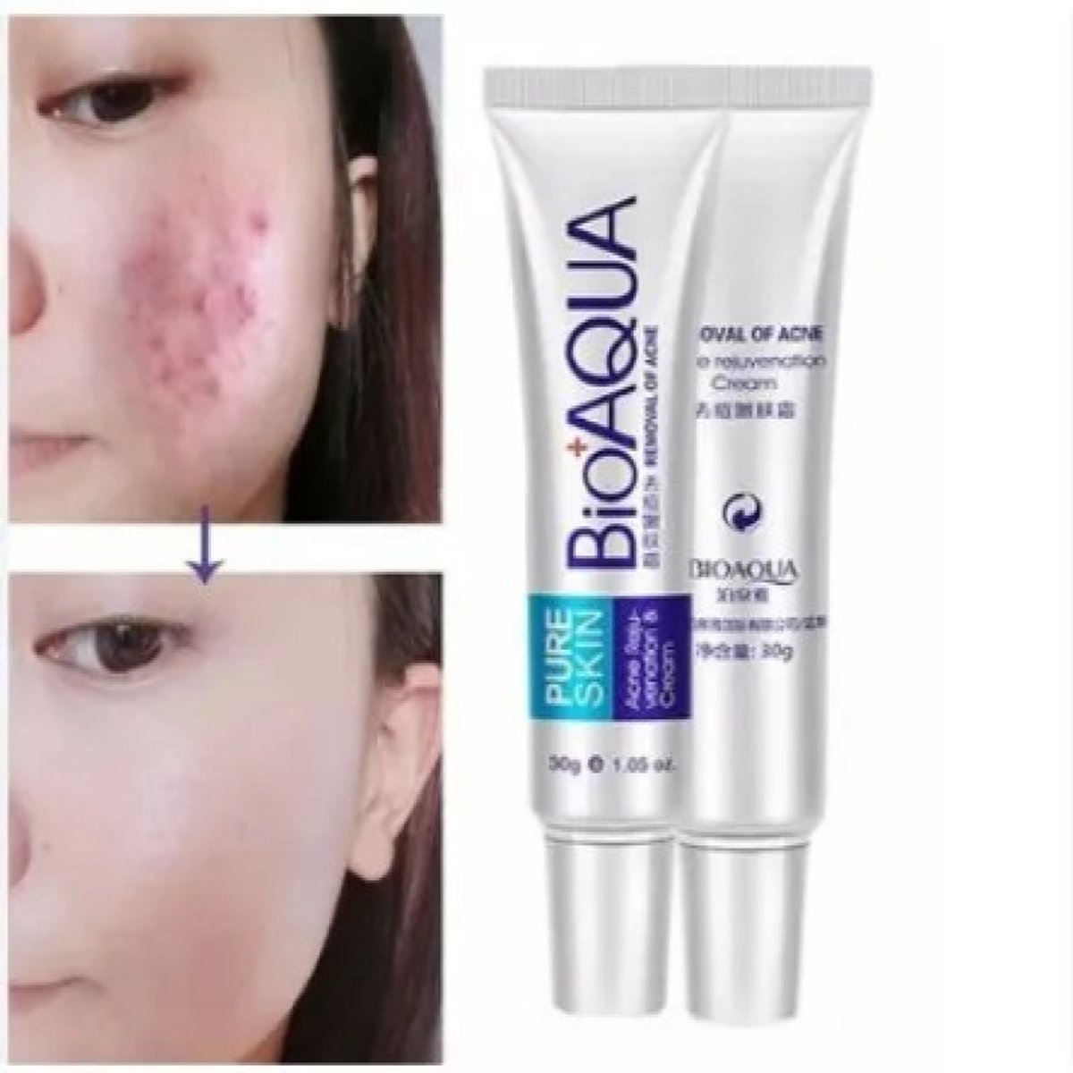 BIOAQUA ACNE REMOVING AND REJUVENATING CREAM - 4
