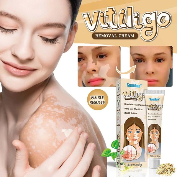 Crema Sumifun Vitiligo 20G..