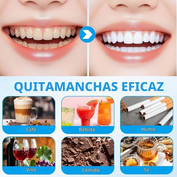 Set de blanqueamiento dental con dispositivo azul - 3