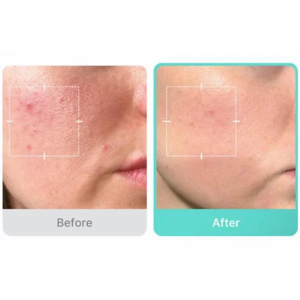 MEDICUBE Azelaic Acid 16 BB Calming Serum Mask