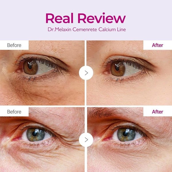 DR. MELAXIN Cemenrete Calcium Dark Spot Eye Cream 15g