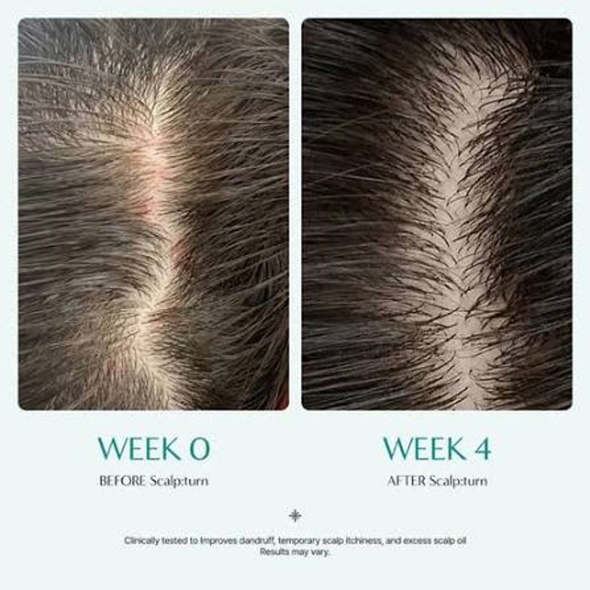 LILYEVE Scalp Turn Cica PDRN Brush Ampoule 100ml - 4