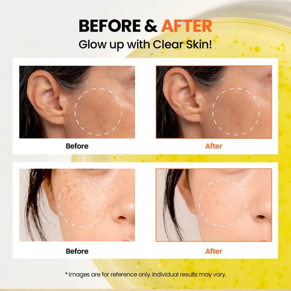 K-SECRET - Seoul 1988 Glow Serum: Niacinamide 15% + Yuja 30ml