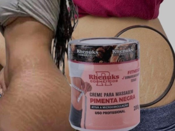Crema para estrías