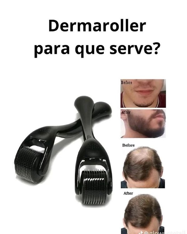 Minoxidil+Derma 🇺🇸