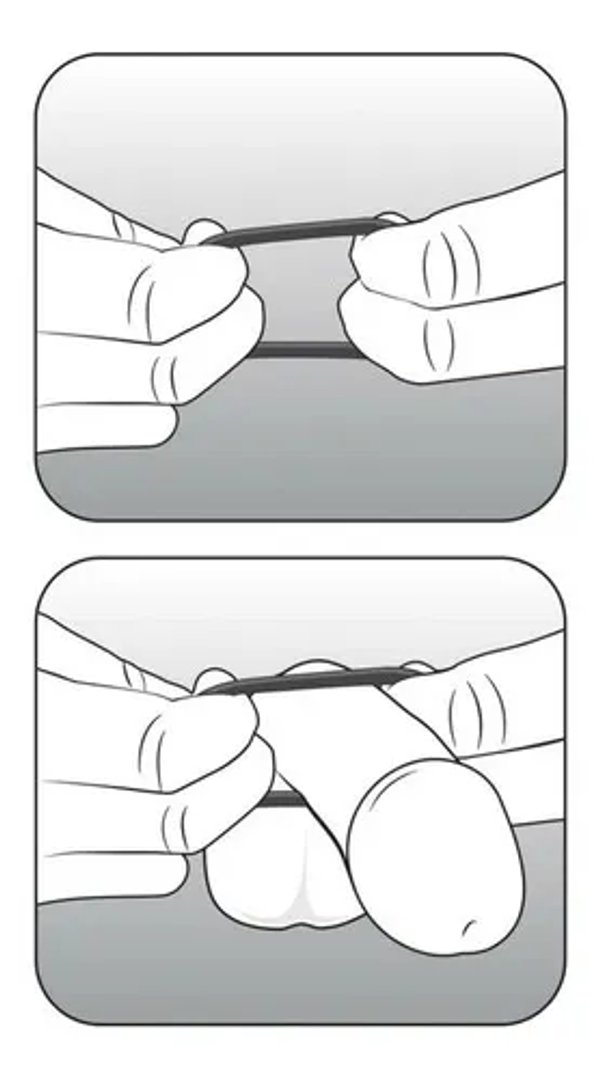 Kit de anillos retardantes 